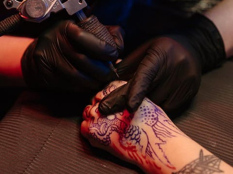 Tattoo verwijderen in Rotterdam